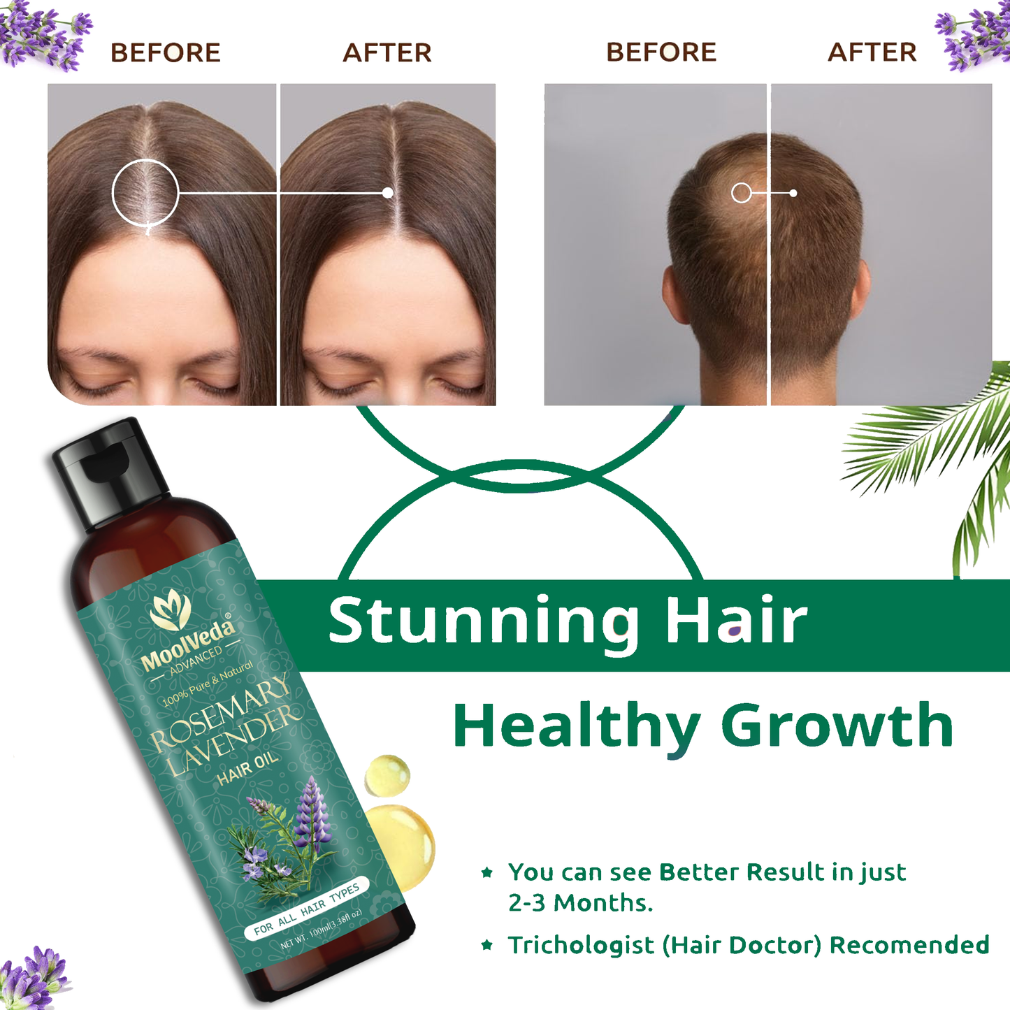 Moolveda Rosemary Lavender Hair Oil-100ml