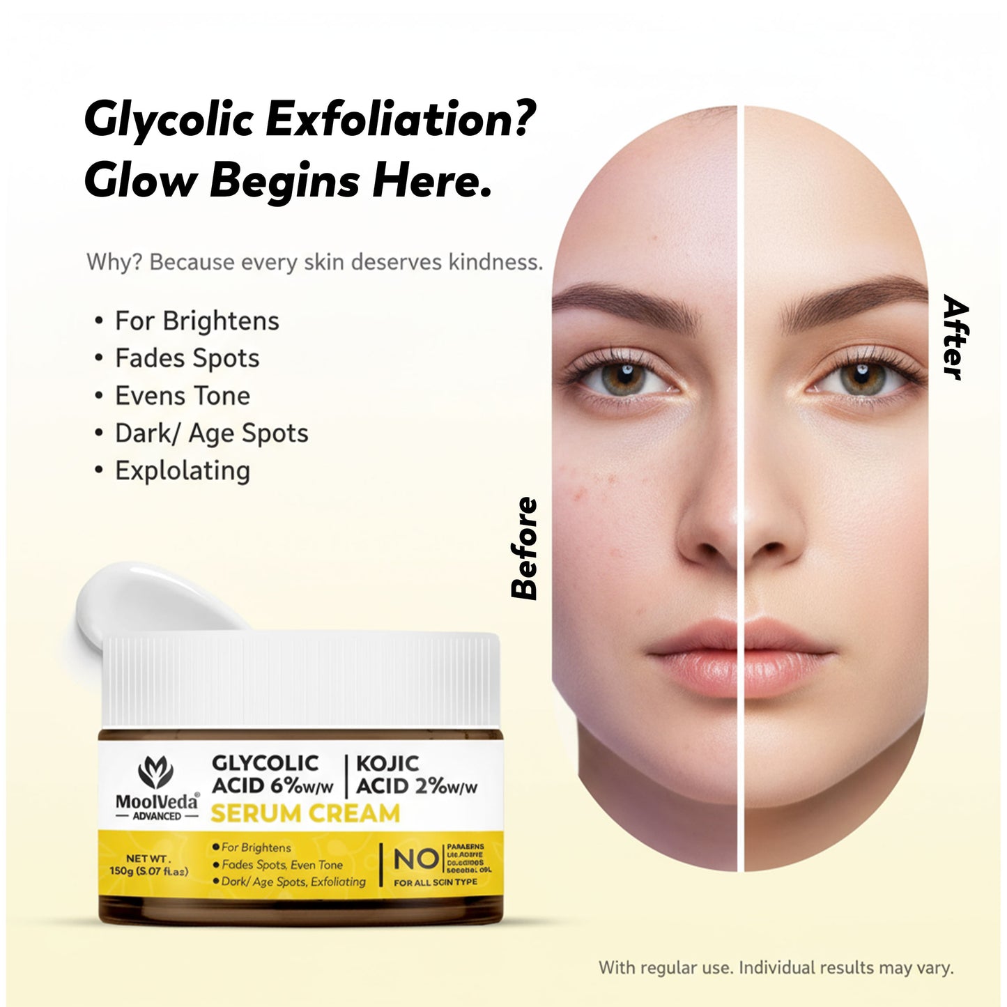 Moolveda 6% Glycolic & 2% Kojic Acid Serum Cream |  150gm