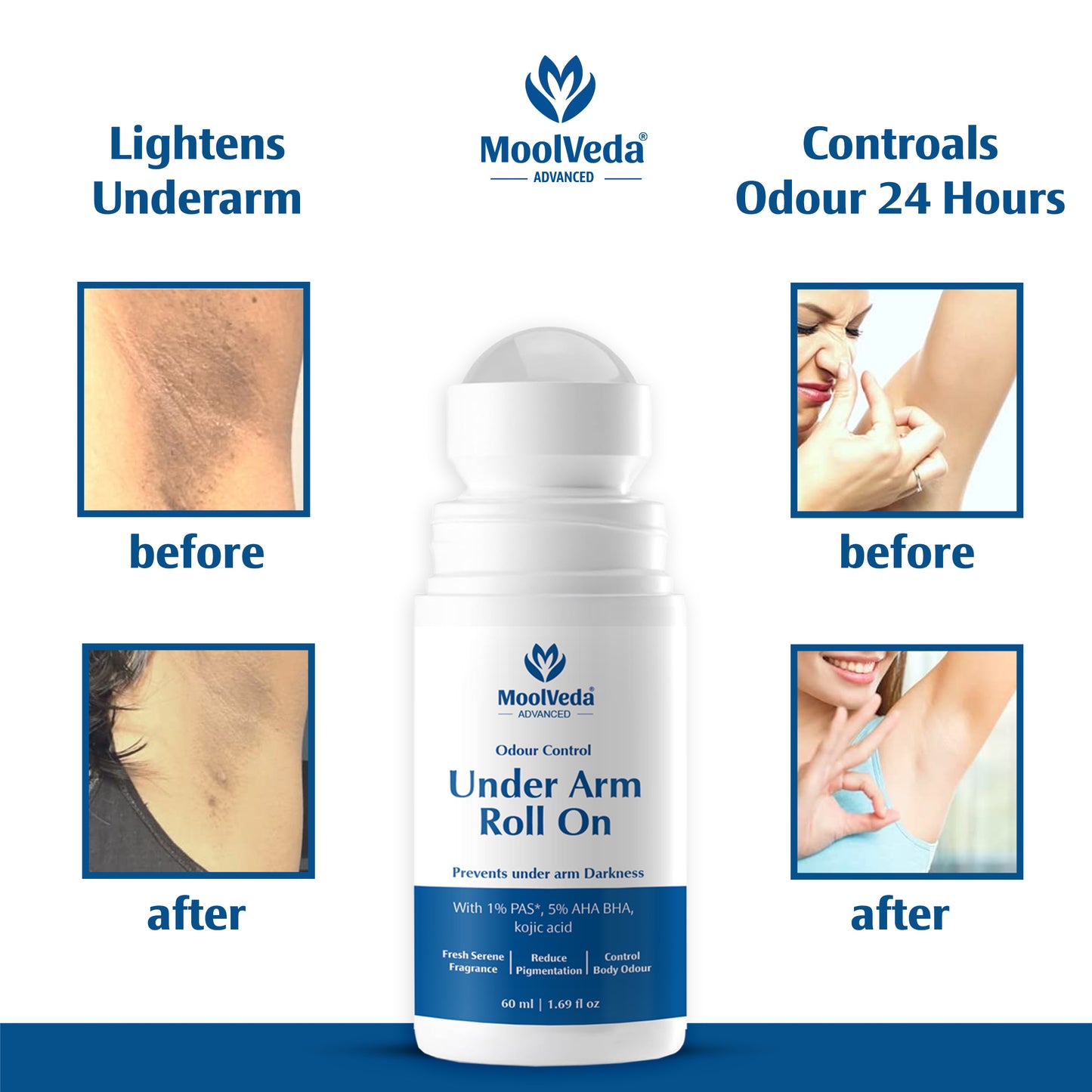 Moolveda Underarm Roll On 60ml