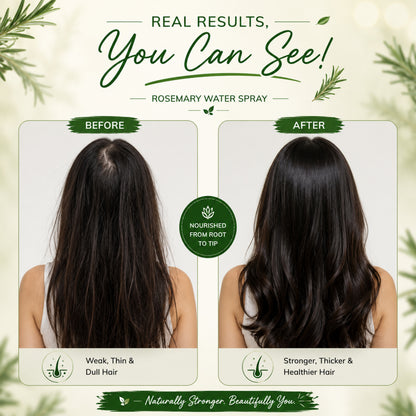 Moolveda Rosemary Water Spray for Hair Growth & Scalp Care | 200ml