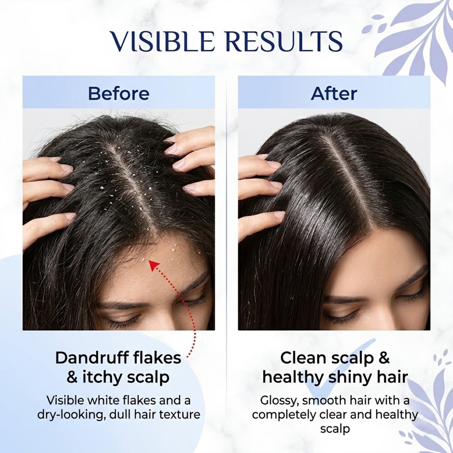 Moolveda Anti Dandruff Shampoo 250ml