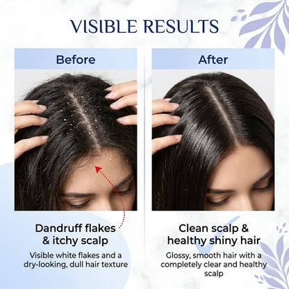 Moolveda Anti Dandruff Shampoo 250ml