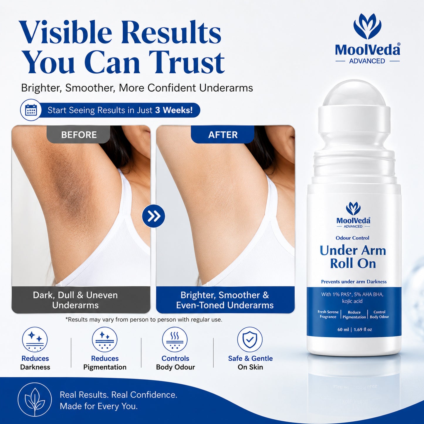 Moolveda Underarm Roll On 60ml (Pack of 2)